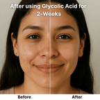 Glycolic Acid 7% Toning Solution - Harmony Hair Essentials ®